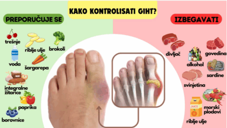 Ishrana kod gihta, sta jesti, sta izbegavati