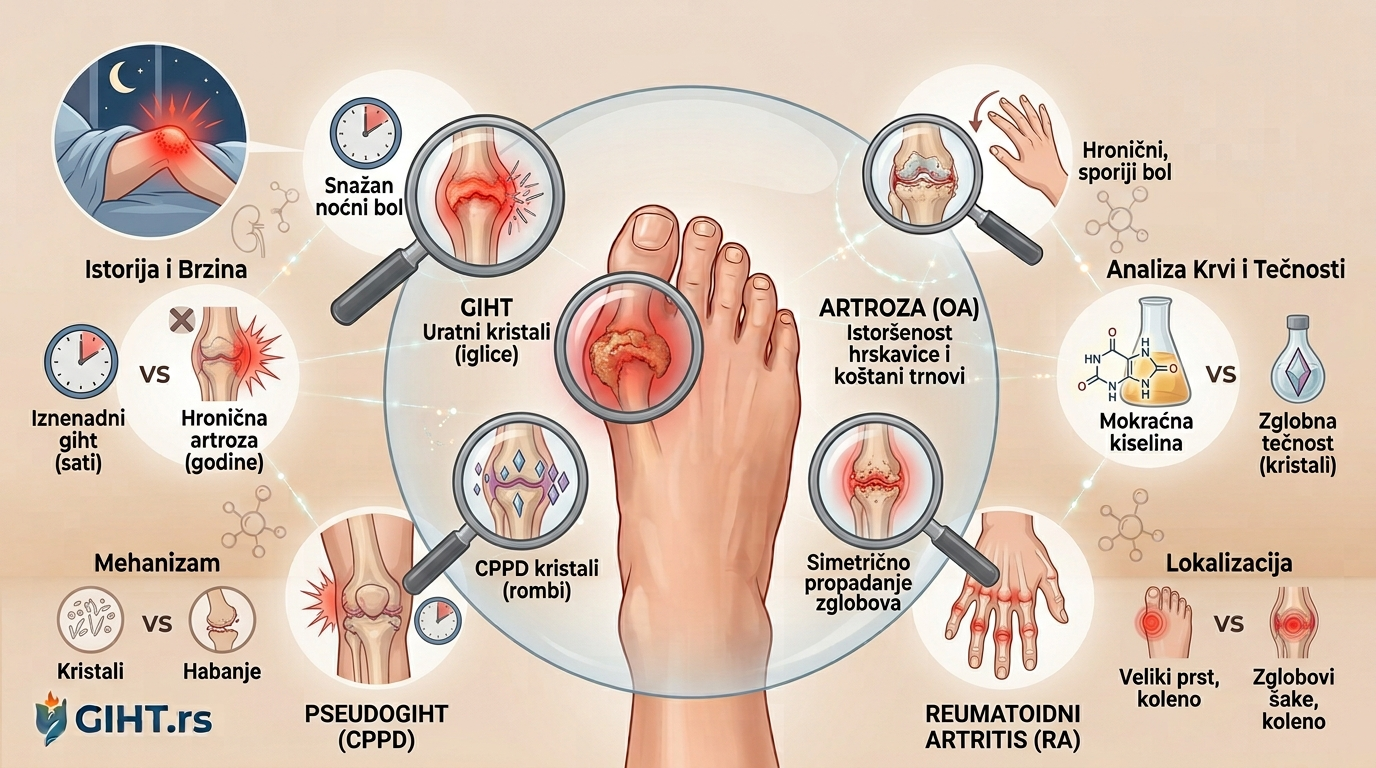 giht-artritis-pseudogiht-artroza-razlike